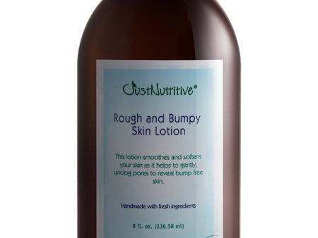 Rough And Bumpy Skin Lotion For Cheap